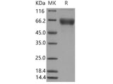 Recombinant Mouse CD80/B7-1 Protein (Fc Tag)(Active)