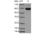 Recombinant Mouse ERK2/MAPK1/MAPK2 Protein (His & GST Tag)