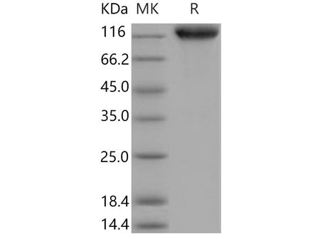 Recombinant Mouse ICAM-1/CD54 Protein (His & Fc Tag)(Active)
