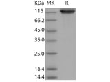 Recombinant Mouse ICAM-1/CD54 Protein (His & Fc Tag)(Active)