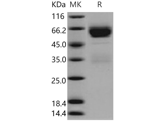 Recombinant Mouse SerpinA11 Protein (His Tag)