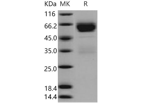 Recombinant Mouse SerpinA11 Protein (His Tag)