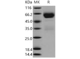 Recombinant Mouse SerpinA11 Protein (His Tag)