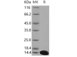 Recombinant Mouse S100A5 Protein (His Tag)