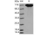 Recombinant Mouse LIFR/CD118 Protein (His Tag)(Active)