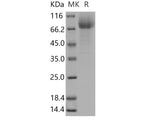 Recombinant Mouse CD36/SCARB3 Protein (His Tag)(Active)
