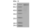 Recombinant Mouse CD36/SCARB3 Protein (His & Fc Tag)(Active)