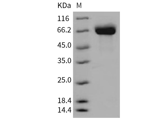 Recombinant Mouse Butyrylcholinesterase/BCHE Protein (His Tag)(Active)