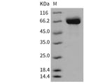 Recombinant Mouse Butyrylcholinesterase/BCHE Protein (His Tag)(Active)