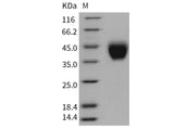 Recombinant Mouse Tissue Factor/CD142 Protein (His Tag)(Active)