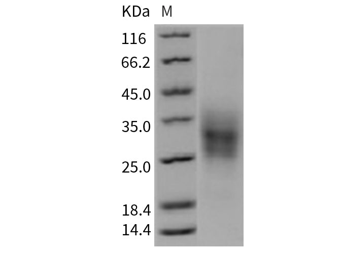 Recombinant Mouse TRAIL R2/TNFRSF10B Protein (His Tag)(Active)