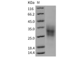 Recombinant Mouse TRAIL R2/TNFRSF10B Protein (His Tag)(Active)