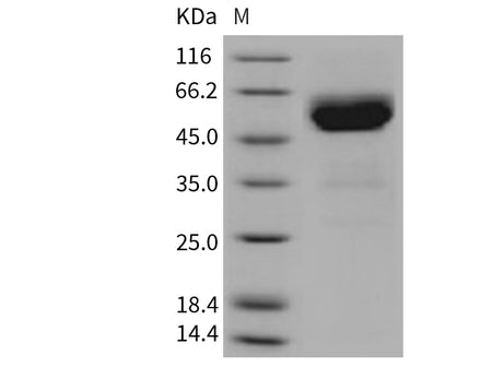 Recombinant Mouse TRAIL R2/TNFRSF10B Protein (His & Fc Tag)(Active)