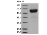 Recombinant Mouse TRAIL R2/TNFRSF10B Protein (His & Fc Tag)(Active)