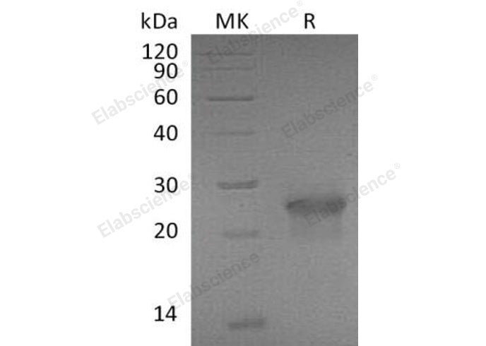 Recombinant Mouse XEDAR/EDA2R Protein (Fc Tag)