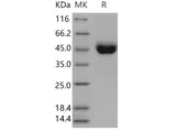 Recombinant Mouse CD5 Protein (aa 1-371, His Tag)