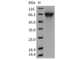 Recombinant Mouse THSD1/TMTSP Protein (His Tag)