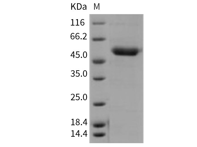 Recombinant Mouse CD39/ENTPD1 Protein (His Tag)(Active)