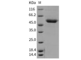 Recombinant Mouse CD39/ENTPD1 Protein (His Tag)(Active)