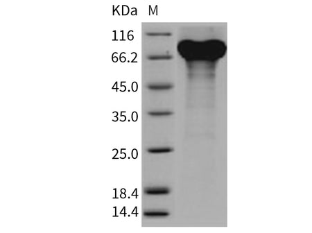 Recombinant Mouse Granulin/GRN/Progranulin Protein (His Tag)