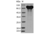 Recombinant Mouse Granulin/GRN/Progranulin Protein (His Tag)