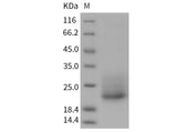 Recombinant Mouse CD7 Protein (His Tag)(Active)