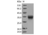 Recombinant Mouse CD8a/Lyt2 Protein (His Tag)(Active)