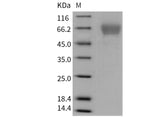 Recombinant Mouse TIM4/TIMD4 Protein (His Tag)