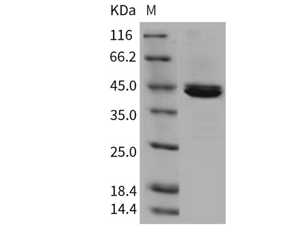 Recombinant Mouse Carboxypeptidase B1/CPB1 Protein (His Tag)(Active)
