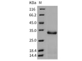 Recombinant Mouse Trypsin 2/PRSS2 Protein (His Tag)(Active)