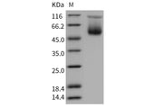 Recombinant Mouse SerpinA3c Protein (His Tag)