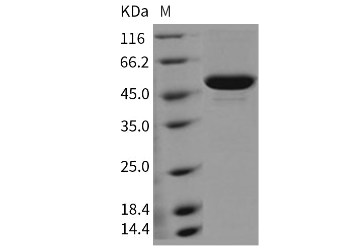 Recombinant Mouse Carboxylesterase 1D/SES1D Protein (His Tag) (Active)