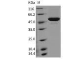 Recombinant Mouse Carboxylesterase 1D/SES1D Protein (His Tag) (Active)