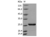 Recombinant Mouse Prolactin/PRL Protein (His Tag)