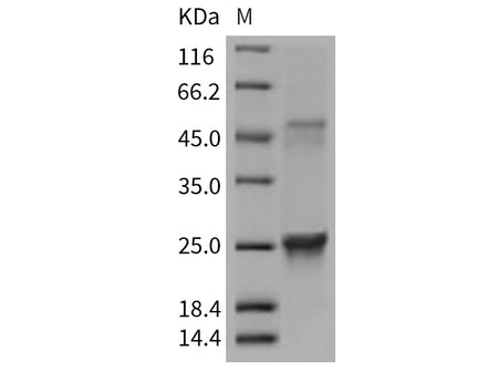 Recombinant Mouse GLO1/Glyoxalase 1 Protein (His Tag)