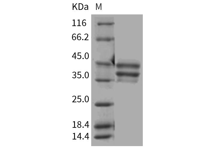 Recombinant Mouse BAFFR/TNFRSF13C/CD268 Protein (Fc Tag)(Active)