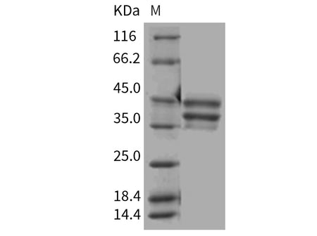 Recombinant Mouse BAFFR/TNFRSF13C/CD268 Protein (Fc Tag)(Active)