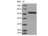 Recombinant Mouse BID Protein (His & GST Tag)(Active)
