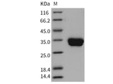 Recombinant Mouse Carbonic Anhydrase 4/CA4 Protein (His Tag)(Active)
