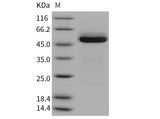 Recombinant Mouse Cathepsin A/CTSA Protein (His Tag)