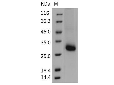 Recombinant Mouse TIMP1/TIMP Protein (Active)