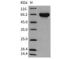 Recombinant Mouse KIRREL3/NEPH2 Protein (His Tag)(Active)