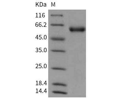 Recombinant Mouse SerpinA8/AGT Protein (His Tag)
