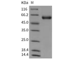 Recombinant Mouse SerpinA8/AGT Protein (His Tag)