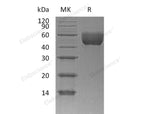 Recombinant Mouse CD147/Basigin Protein (aa 1-209, His Tag)