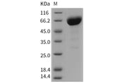 Recombinant Mouse CD147/Basigin Protein (His & Fc Tag)(Active)