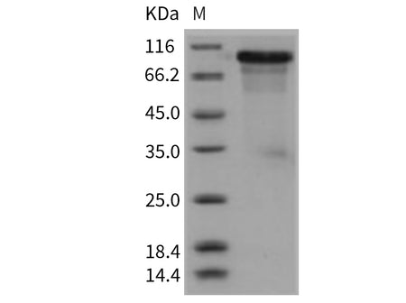 Recombinant Mouse ECM1 Protein (His Tag)(Active)