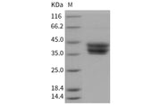 Recombinant Mouse CD157/BST1 Protein (His Tag)