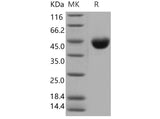 Recombinant Mouse CD112/Nectin-2 Protein (His Tag)(Active)