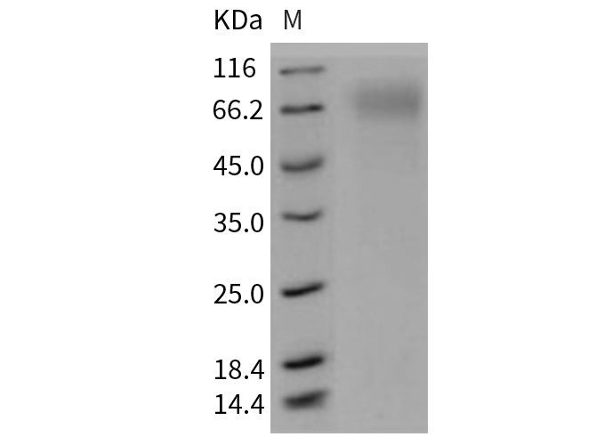 Recombinant Mouse SR-BI/CD36L1 Protein (His Tag)
